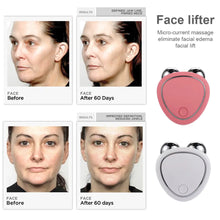 Load image into Gallery viewer, FeelLift™ - Microcurrent Face Lift Roller
